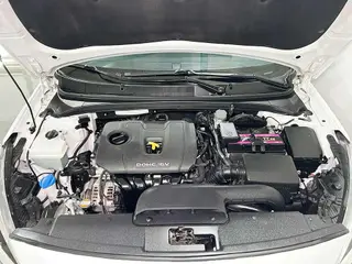 Hyundai Mistra 2017 1.8L automatic intelligent type GLS China V exterior photo 8 Hyundai Mistra 2017 1.8L automatic intelligent type GLS China V exterior photo 8